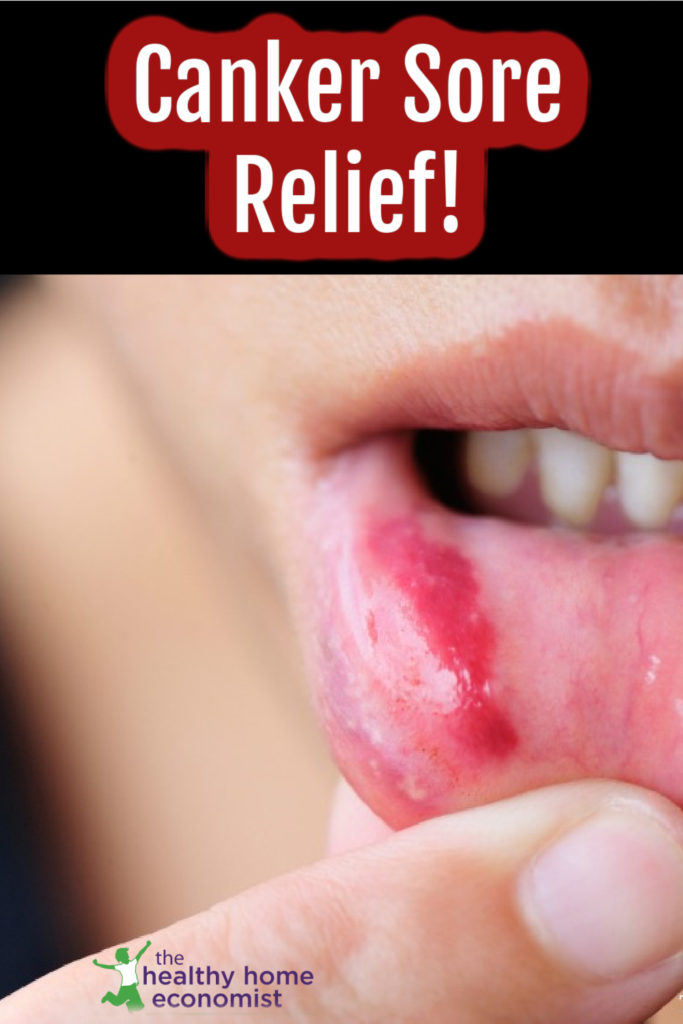 healing canker sore on lower lip