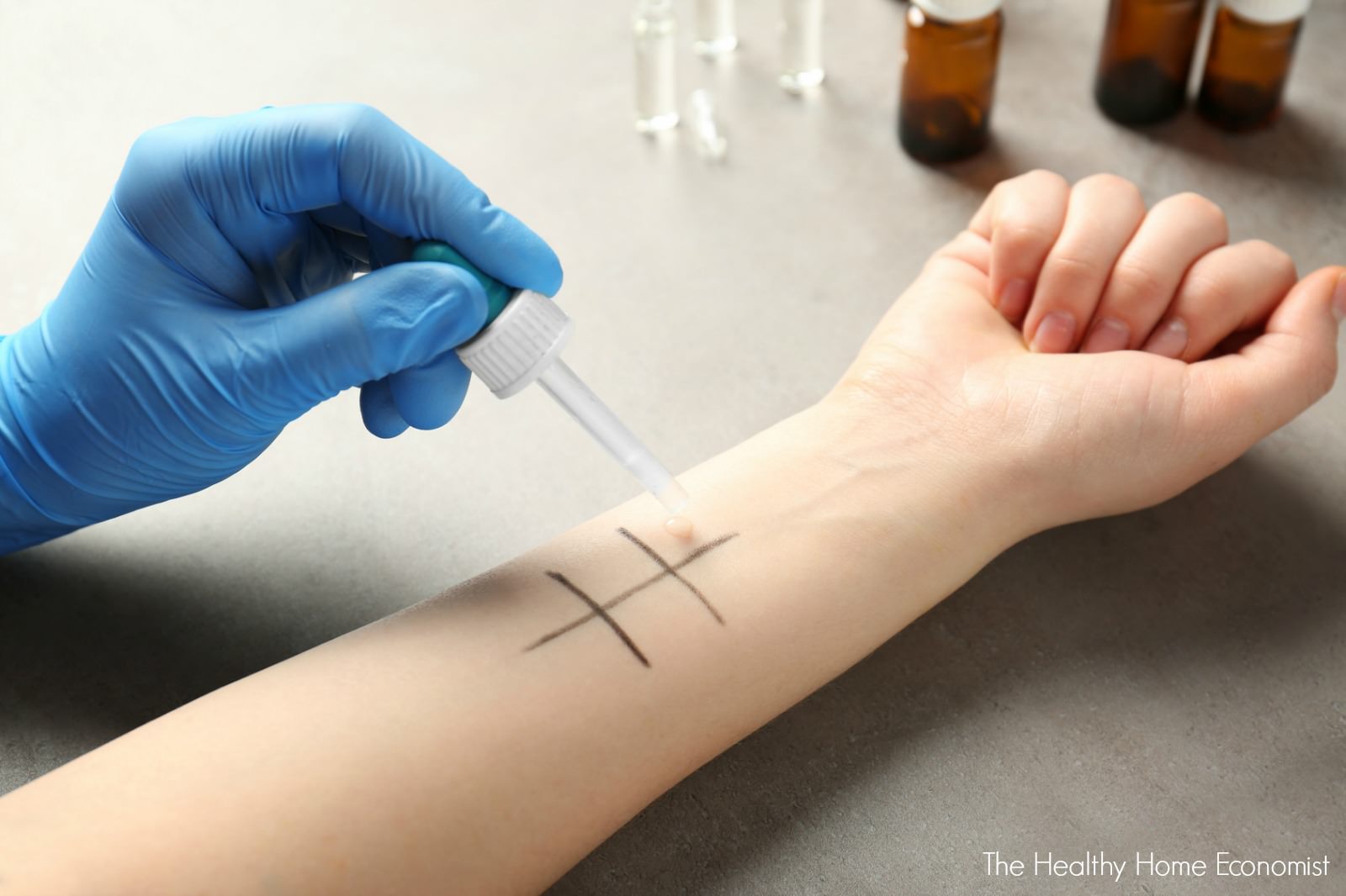 How to do skin allergy test at home grizzbye