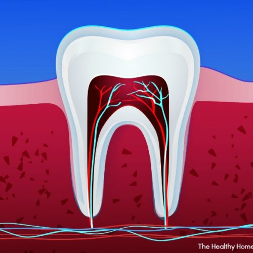 Holistic Alternatives to Root Canals Healthy Home Economist