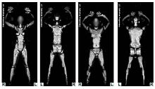 body scanner