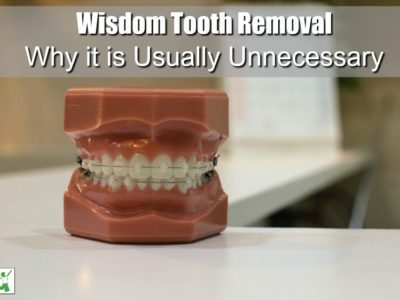 wisdom tooth removal