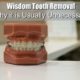 wisdom tooth removal