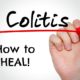 ulcerative colitis GAPS