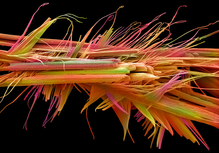 caffeine crystals in an electron microscope