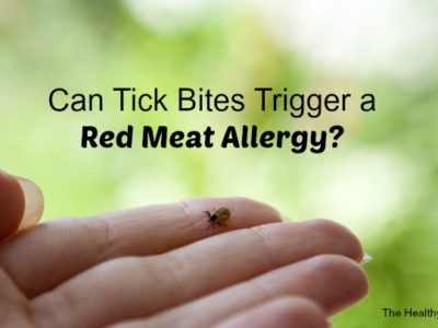 red meat allergy from tick bite