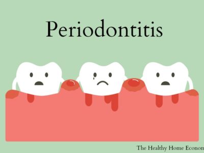 periodontal problems