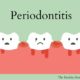 periodontal problems