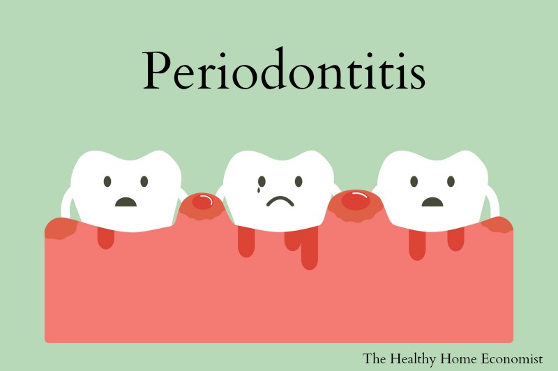 periodontal problems