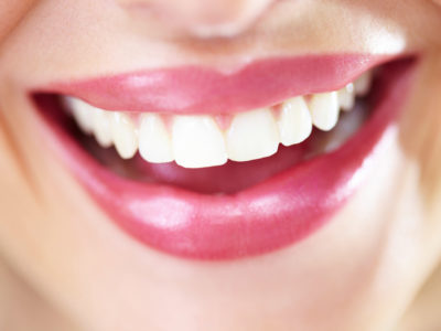 Whiten Teeth Naturally With No Dangerous Chemicals