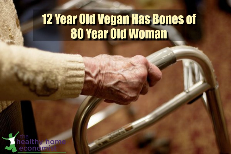 old woman with crumbling bones like a child vegan