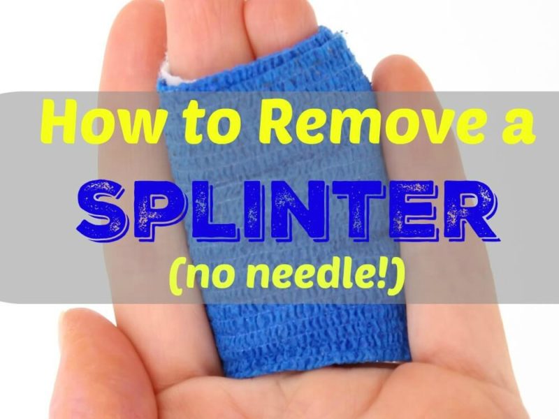 how to remove a splinter
