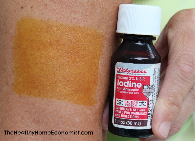 bottle of 2% iodine painted in a patch on a woman's arm