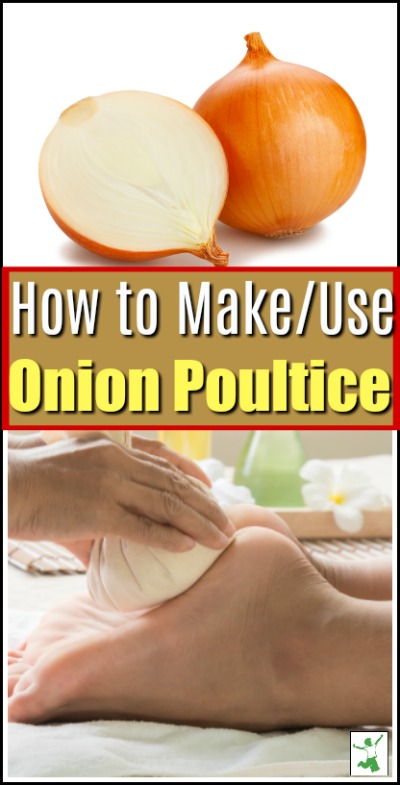 diy onion poultice for coughs