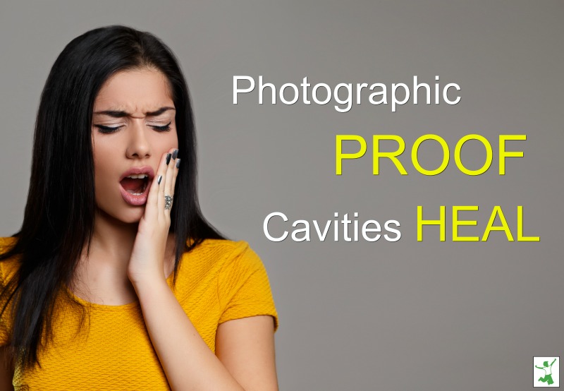 proof of healed cavities