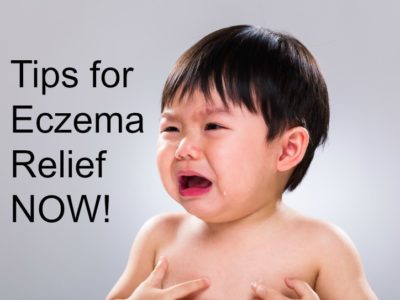 Tips for Eczema Relief NOW (while healing from within)