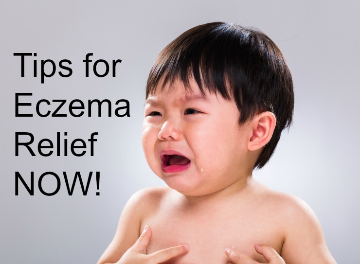 child who needs eczema relief