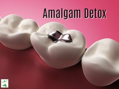 amalgam mercury detox