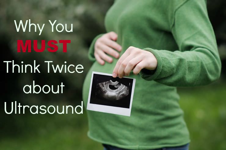 woman holding prenatal ultrasound picture