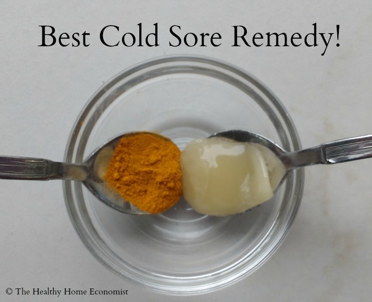 best remedy for cold sores
