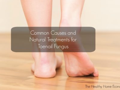 toenail fungus causes and cures