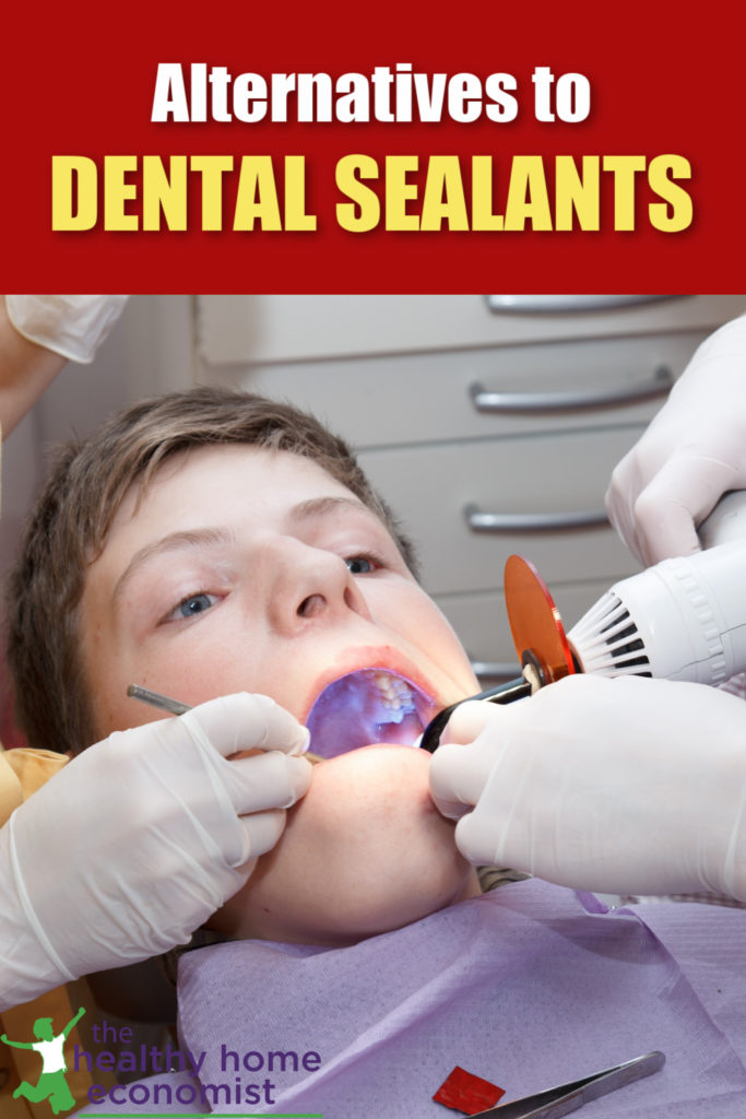 child with sealants applied to teeth