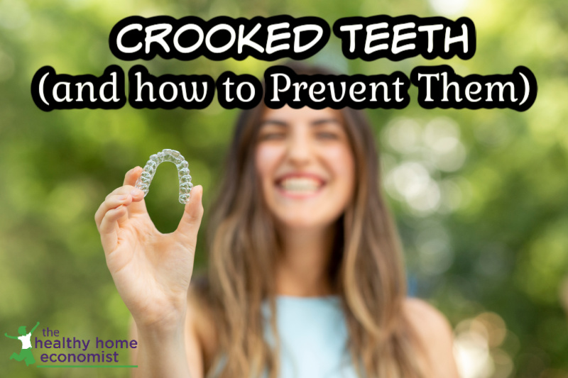 young woman holding retainer for braces