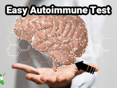 autoimmune issues target cerebellum in the brain