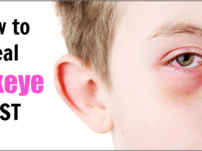 fast pinkeye home remedy for boy with conjunctivitis