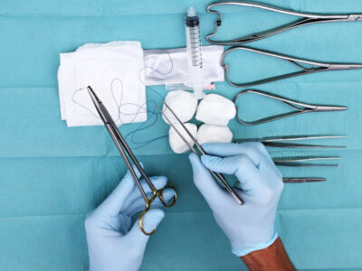 surgical tools on a table for vasectomy side effects