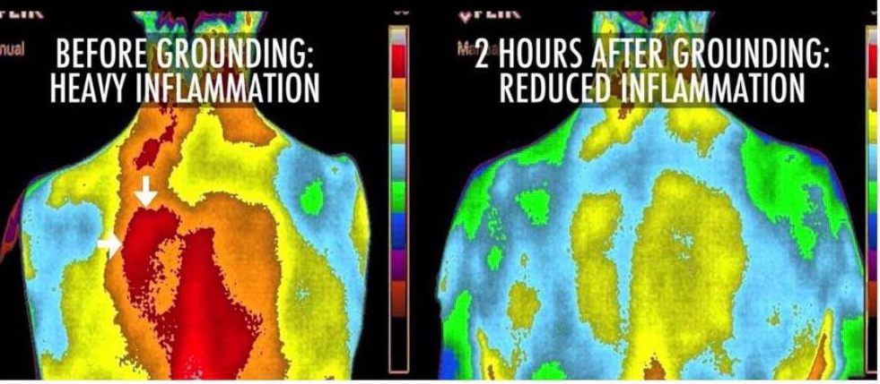 person with inflammation before and after earthing