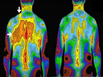 man with inflammation healing with free electrons