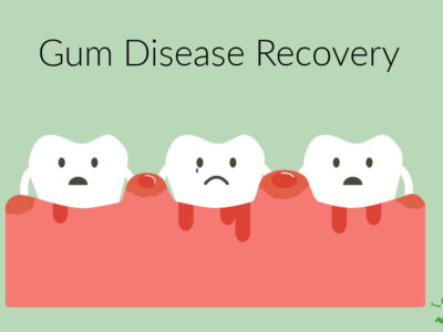 teeth with gum disease and periodontitis