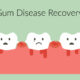 teeth with gum disease and periodontitis