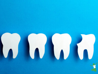 tooth with a cavity in need of hydroxyapatite